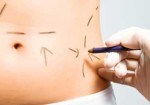 cirurgia-plastica-em-embu-das-artes-1441042373